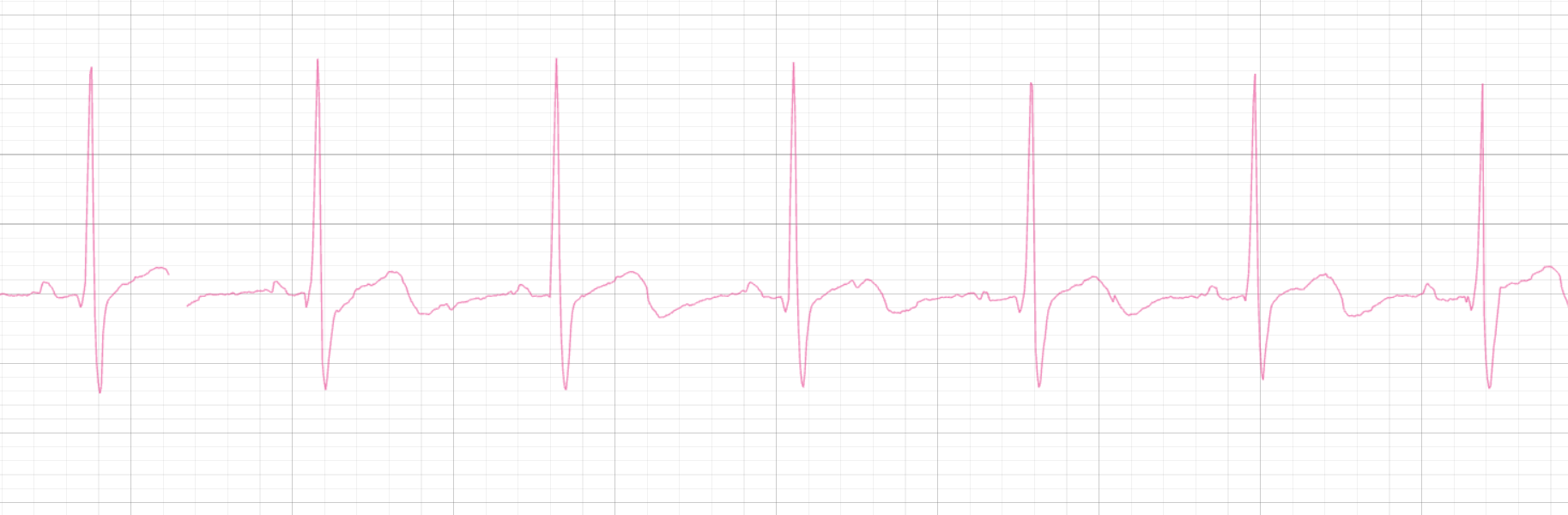 Interface in Light Mode