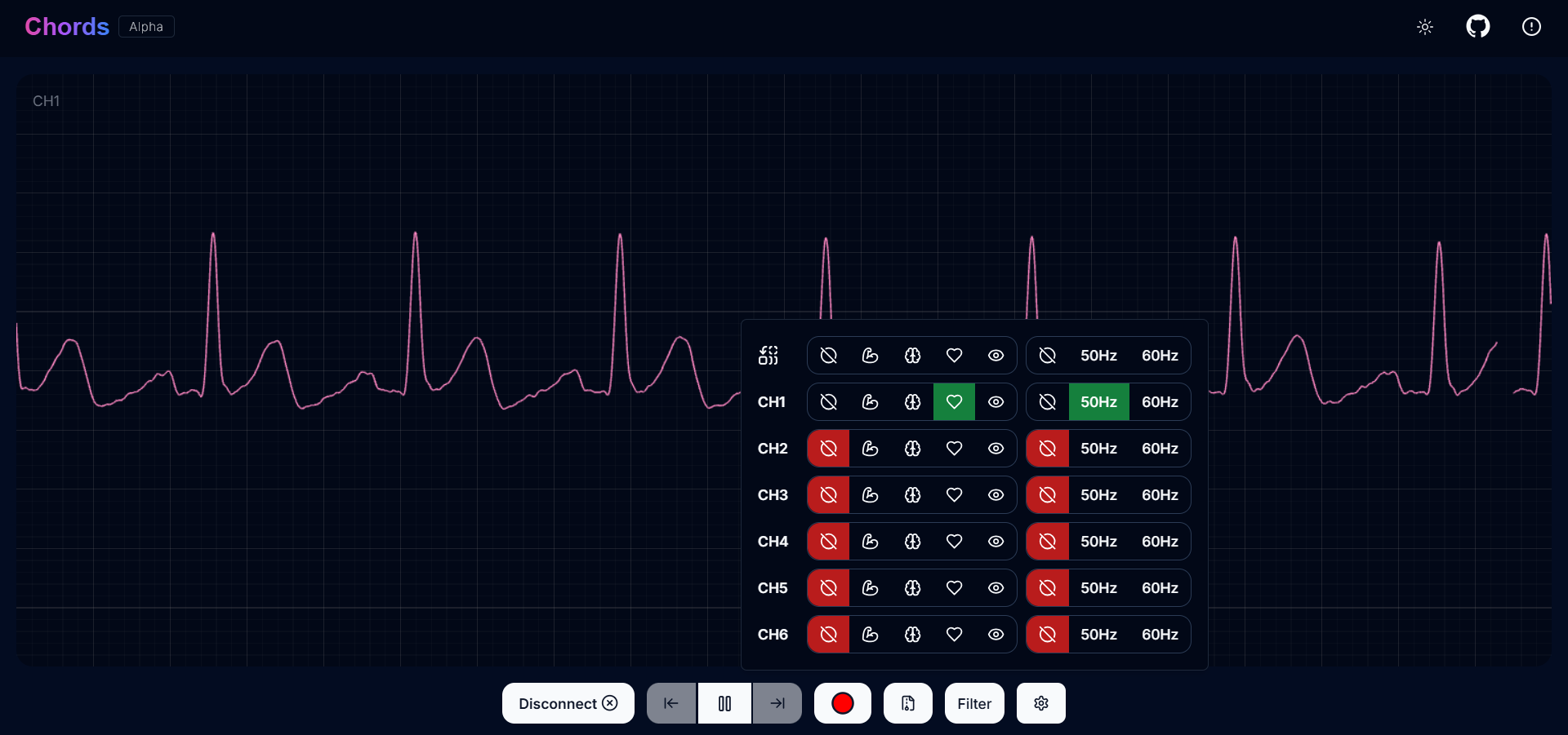 Memvisualisasikan sinyal ECG di Chords Web