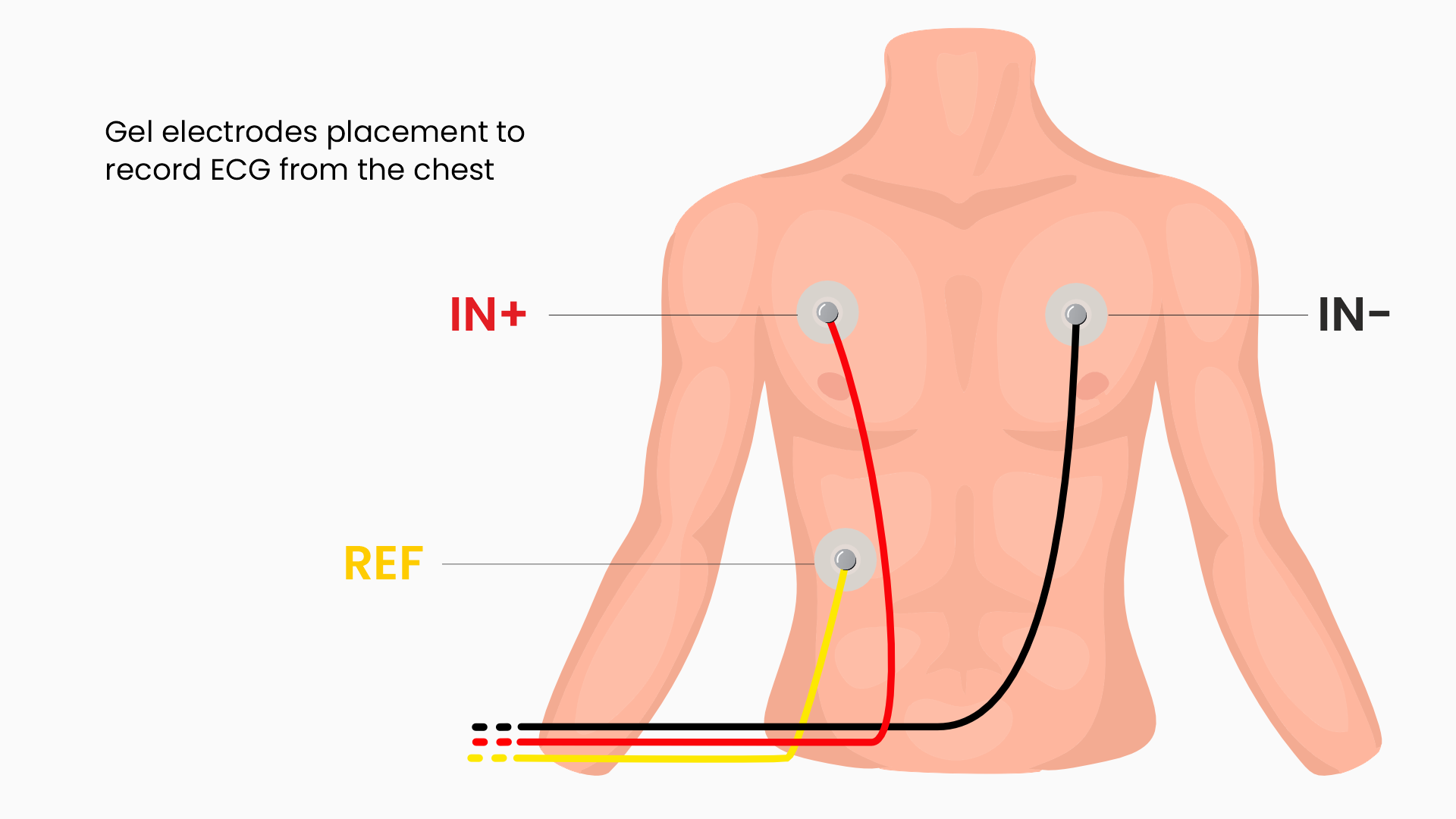 Penempatan elektroda untuk ECG