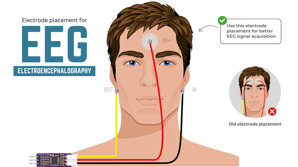 Penempatan elektroda untuk EEG