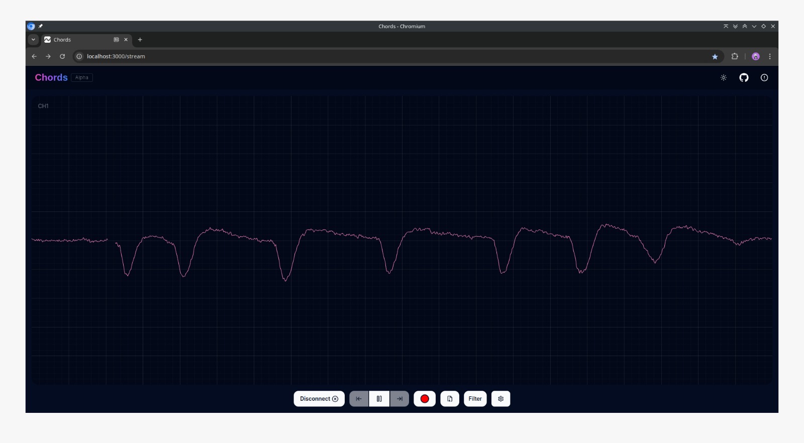 Bentuk gelombang kedipan mata