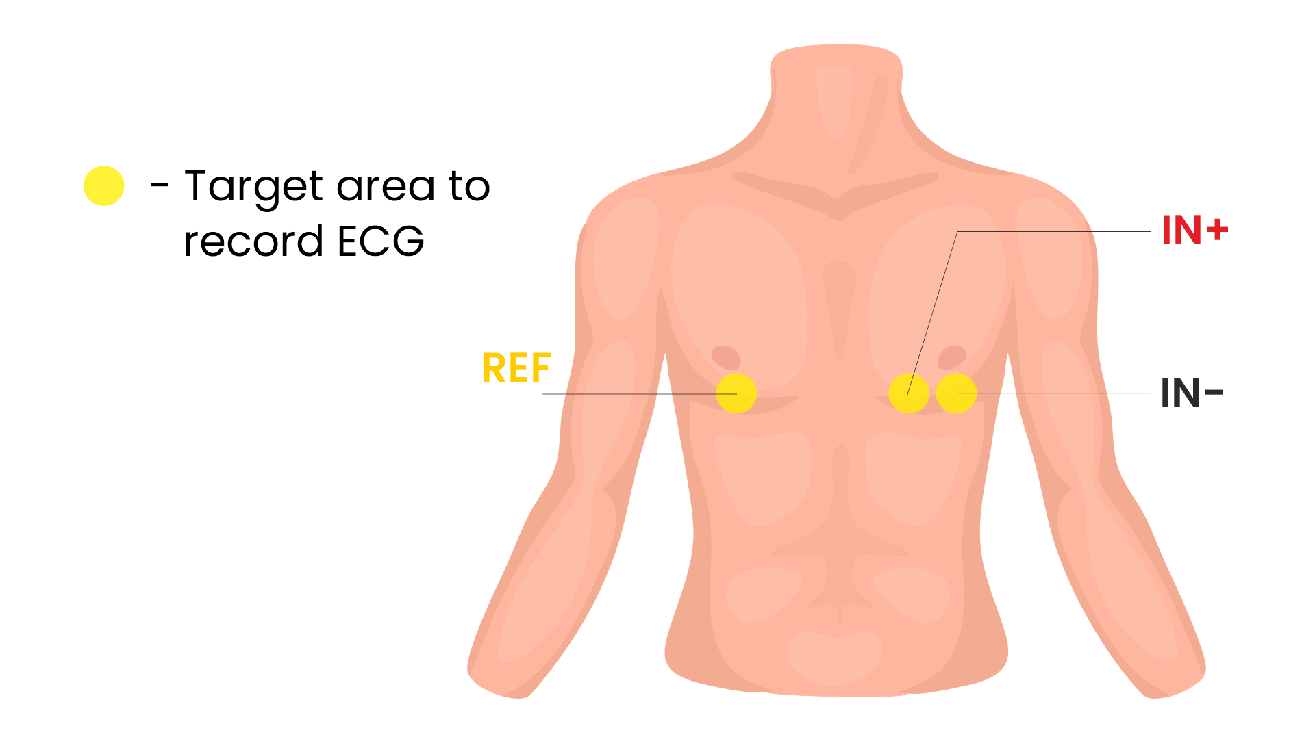 Penempatan ECG