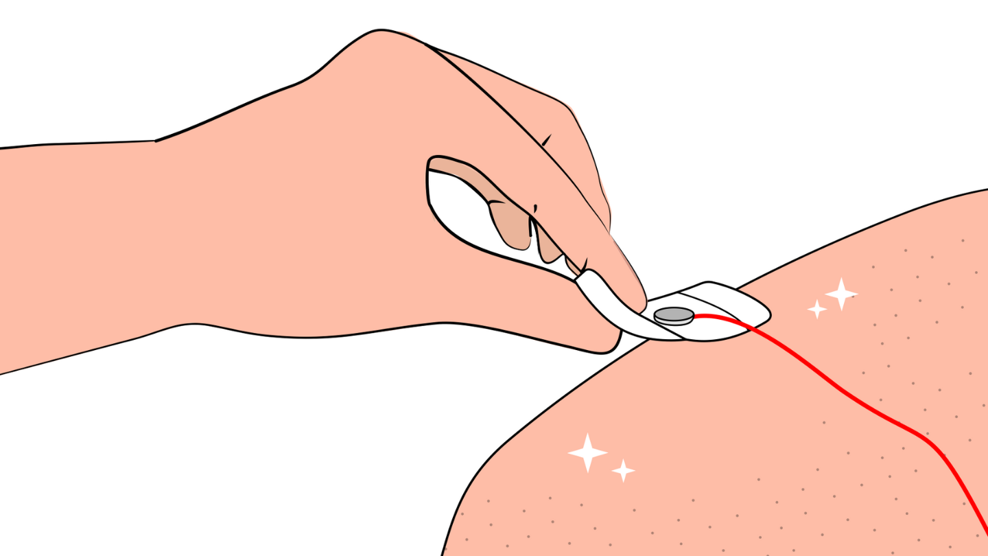 Menempatkan elektroda gel pada permukaan kulit